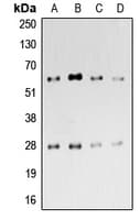 Polyclonal Rabbit anti-Human CD69 Antibody (Internal, WB)