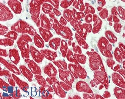 IHC-plus™ MYL4 Antibody (aa2-197, clone 5A2)