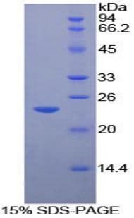 Mouse MST1R / RON Protein (Recombinant His-T7)