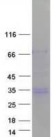 Human CD99 Protein (Recombinant Myc-DDK (Flag))
