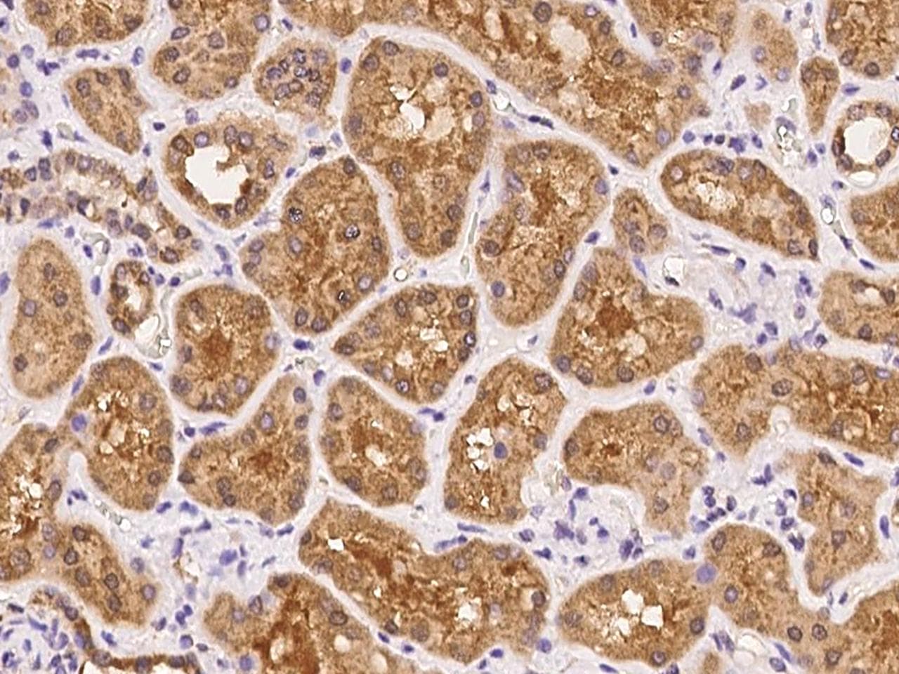 Polyclonal Rabbit anti-Human UPK3B Antibody (IHC)