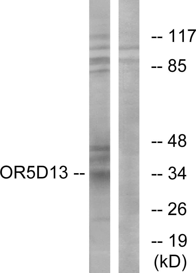 OR5D13 Antibody (aa265-314)