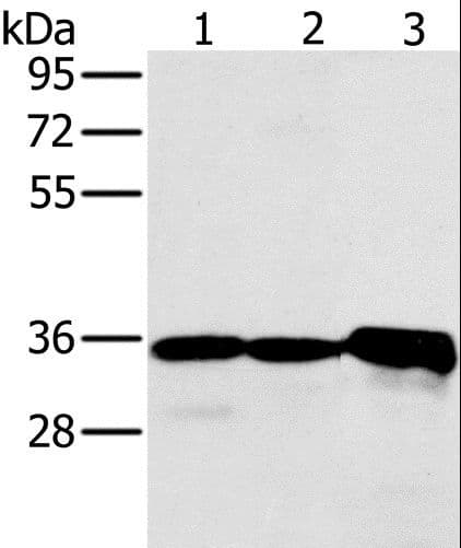 Polyclonal Rabbit anti-Human NDUFA9 Antibody (WB)