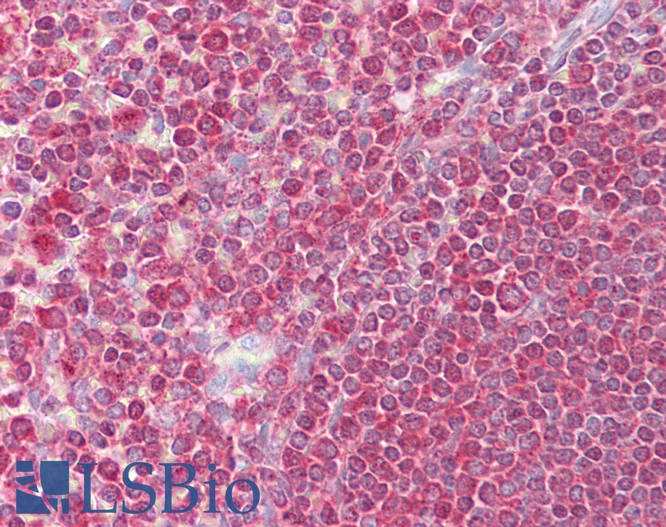 EGR3 Antibody (aa35-84)