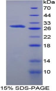 Rat PROS1 / Protein S (Recombinant His-T7)
