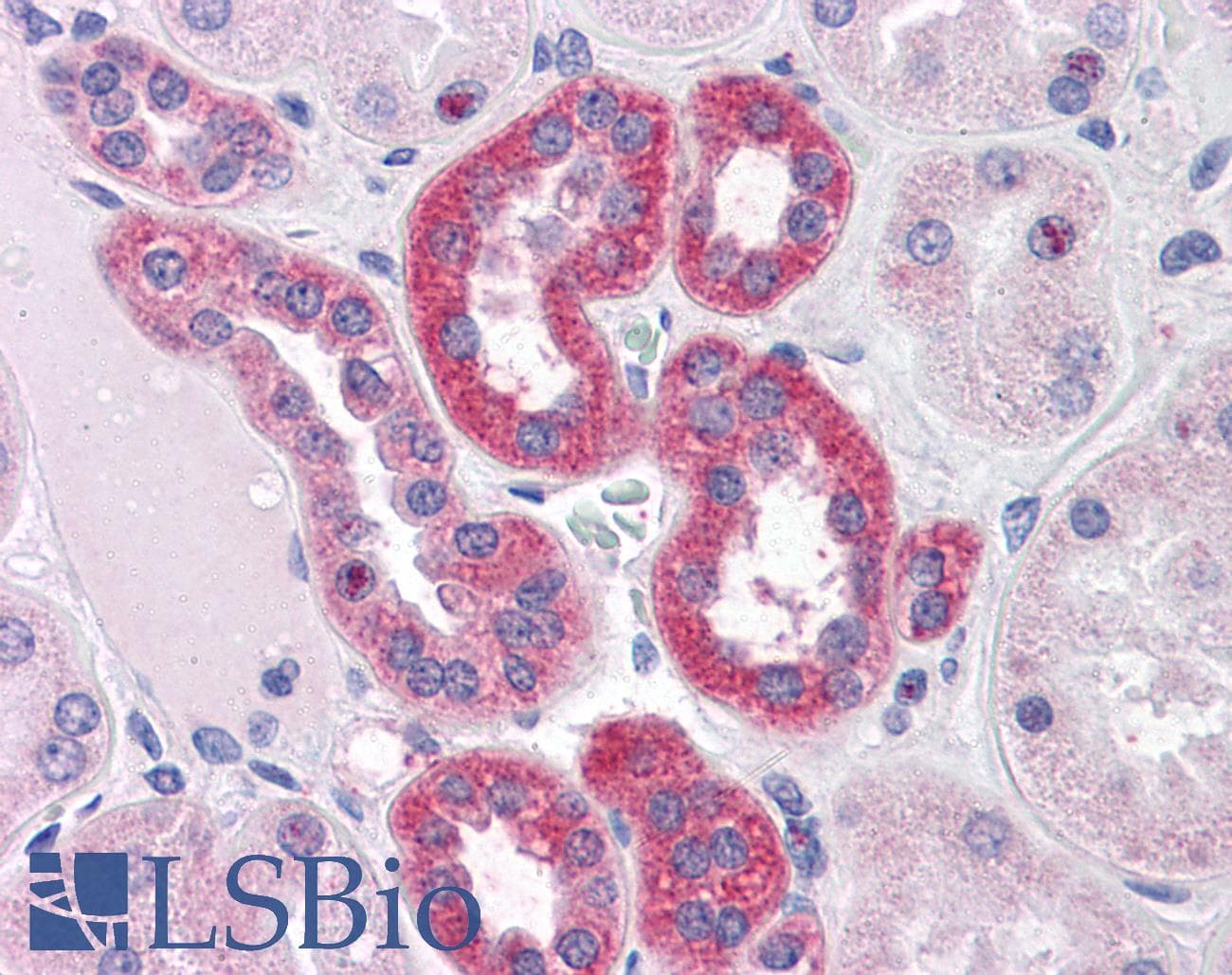 IHC-plus™ Polyclonal Goat anti-Human PARP3 Antibody (aa90-104, IHC)