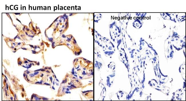 hCG / Chorionic Gonadotropin Antibody (clone 3015)
