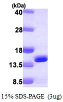 Human DNAJC19 Protein (Recombinant His)