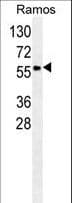 SERPINA9 Antibody (aa158-186)
