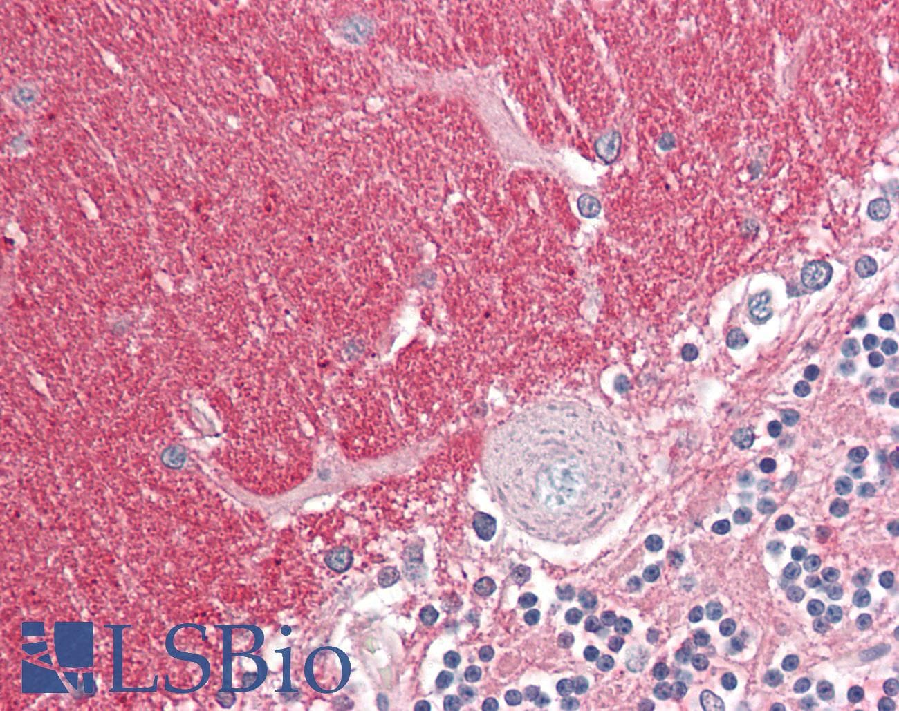 IHC-plus™ Polyclonal Goat anti-Human GNB3 Antibody (aa309-321, IHC, WB)