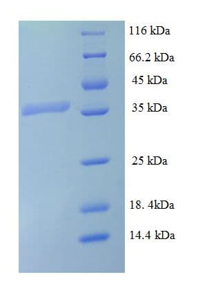 Mycobacterium tuberculosis Signal Peptidase I Protein (Recombinant His-SUMO)