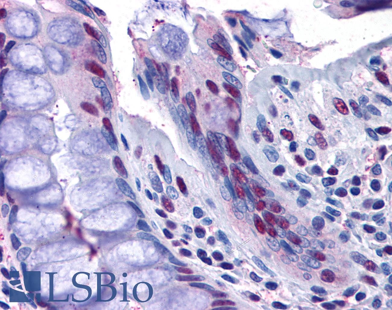 IHC-plus™ NAT10 Antibody (aa917-928)