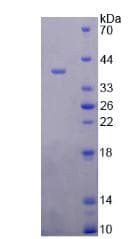 Human FOLH1 / PSMA Protein (Recombinant His, N-Terminal)