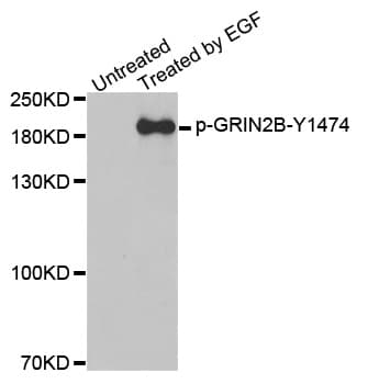 GRIN2B / NMDAR2B / NR2B Antibody (phospho-Tyr1474)