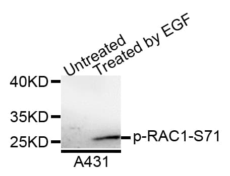 Polyclonal Rabbit anti-Human RAC1 Antibody (phospho-Ser71, WB)