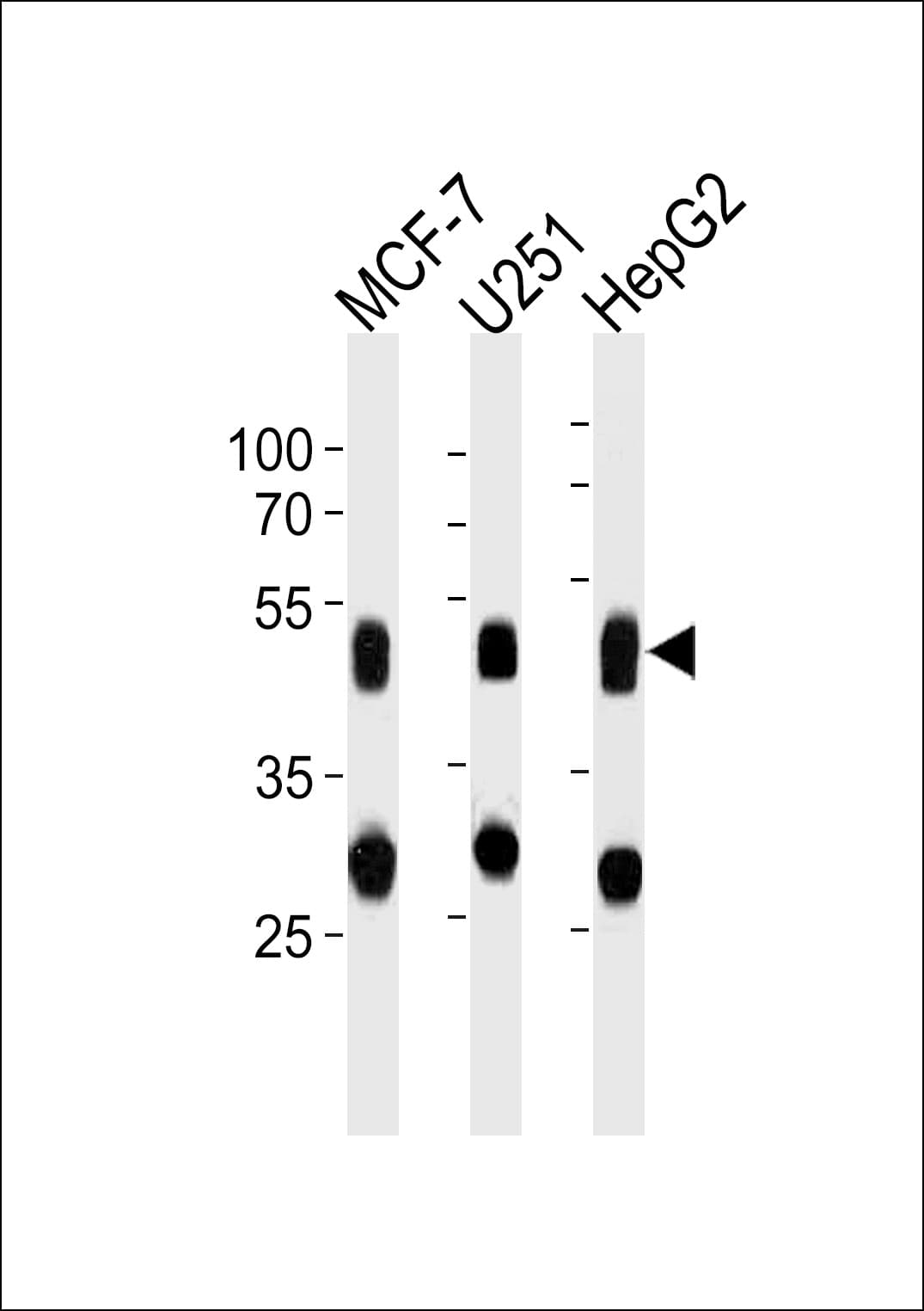 Monoclonal Mouse anti-Human CTSD / Cathepsin D Antibody (clone 892CT11.1.1, WB)