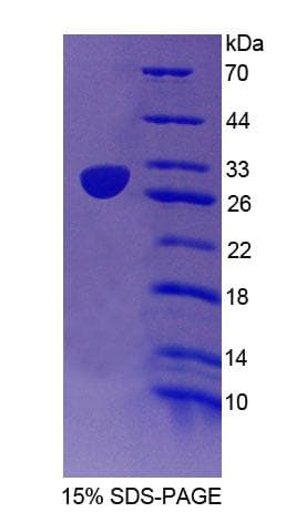 Human CD48 Protein (Recombinant His-T7)