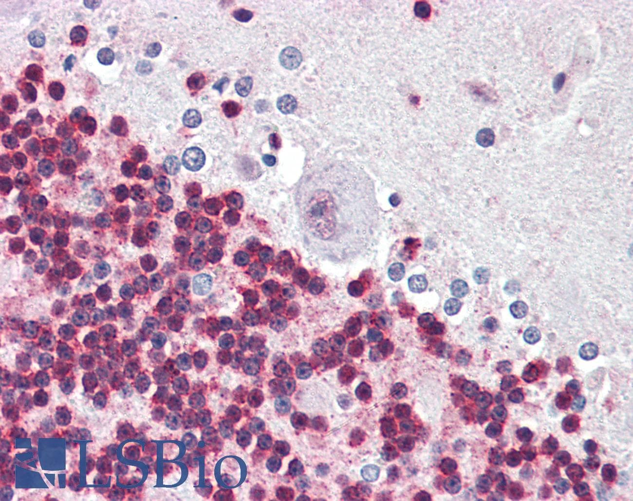 IHC-plus™ PHAP1 / ANP32A Antibody