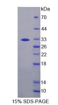 Mouse PZP Protein (Recombinant His-S)