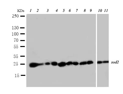 Polyclonal Rabbit anti-Human SOD2 / Mn SOD Antibody (aa45-62, IHC, WB)