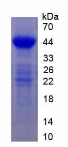 Human EGFR Protein (Recombinant His, N-terminus)