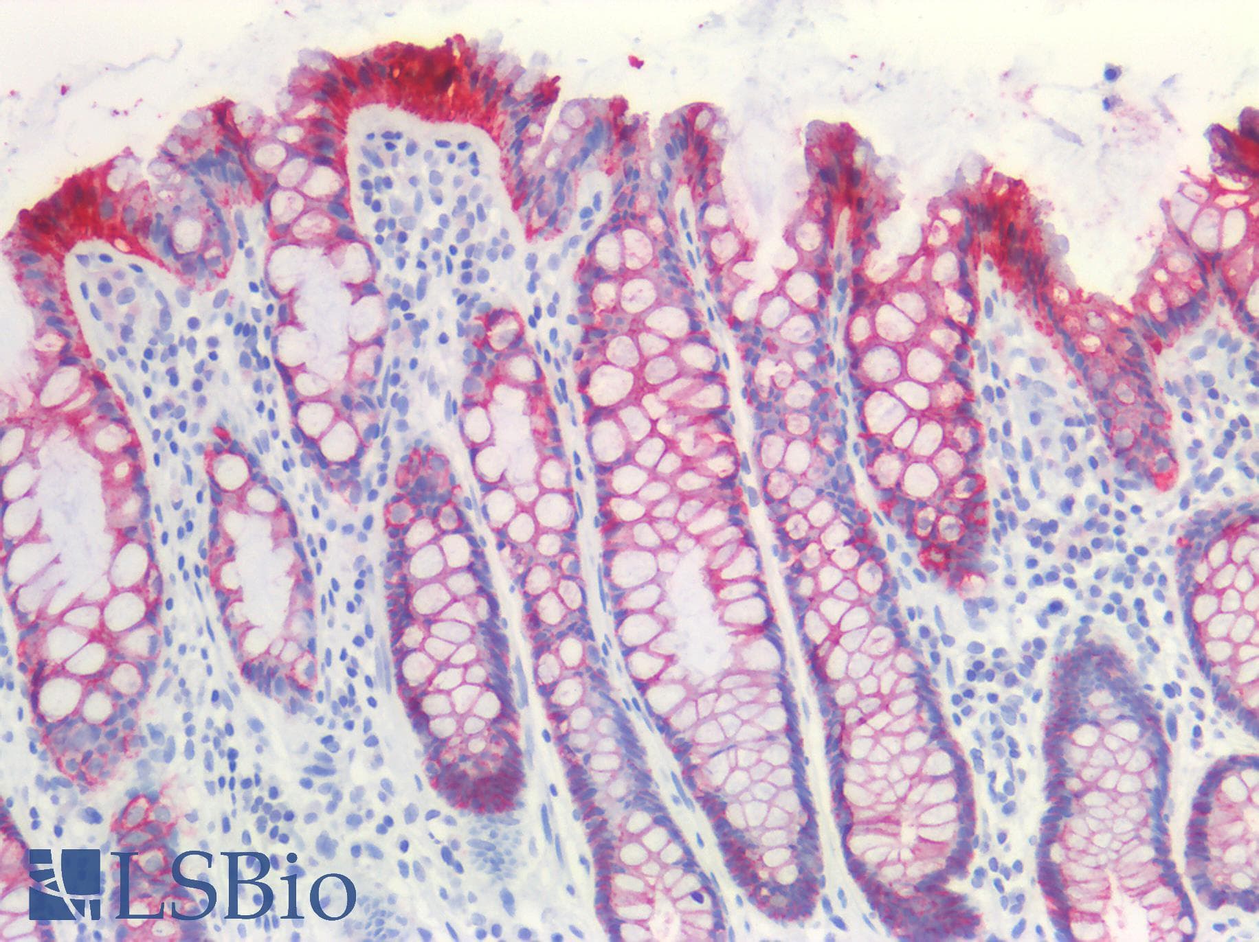 PathPlus™ CLDN4 / Claudin 4 Antibody (C-Terminus, clone 3E2C1)