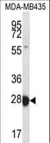 Polyclonal Rabbit anti-Human RAB27B Antibody (aa121-150, IHC, WB)