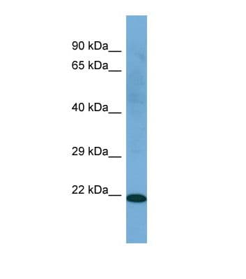 C21orf2 Antibody (aa173-222)