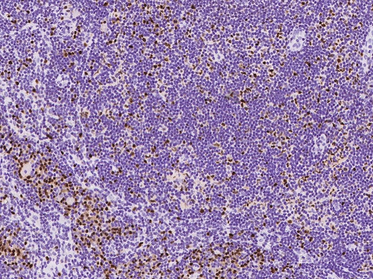 Polyclonal Rabbit anti-Human IRF4 Antibody (IHC)