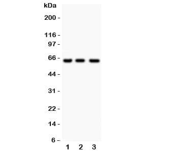 RELA / NFKB p65 Antibody (aa99-551)