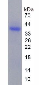Mouse CCL11 / Eotaxin Protein (Recombinant His-GST, N-terminus)