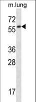Polyclonal Rabbit anti-Mouse SYN / FYN Antibody (aa507-535, WB)