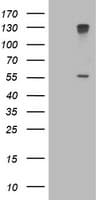 CYP17 / CYP17A1 Antibody (clone OTI3D9)