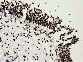 Monoclonal Mouse anti-Human SULT1A1 / Sulfotransferase 1A1 Antibody (clone OTI9B7, IHC, IF, WB)