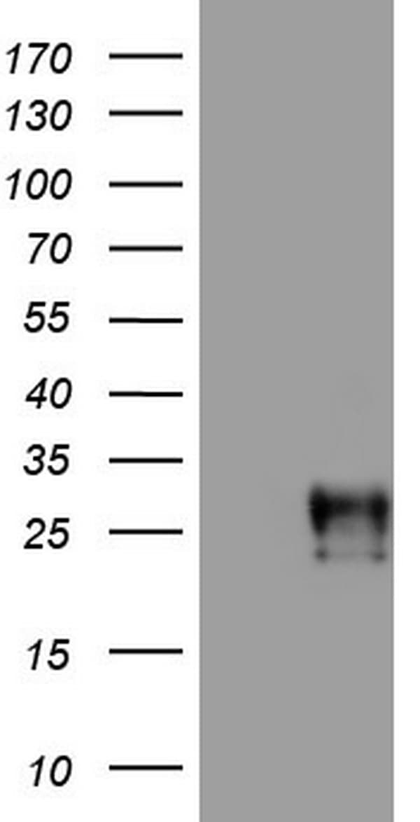 Adiponectin Antibody (aa19-244, clone OTI1A8)