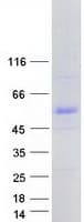 Human PML Protein (Recombinant Myc-DDK (Flag))