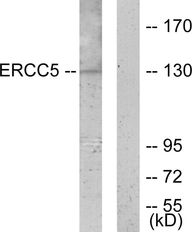 ERCC5 / XPG Antibody