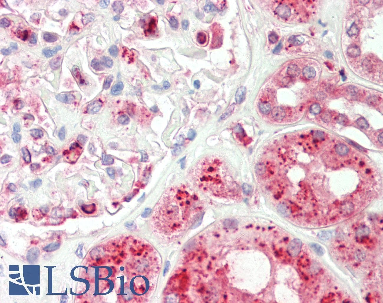 IHC-plus™ TRAM1 Antibody (aa310-374)