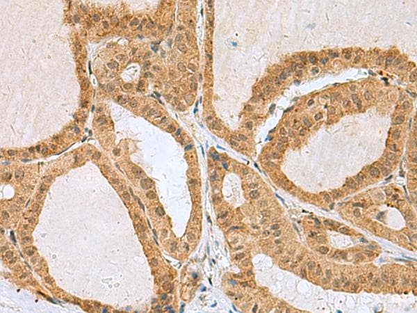 EXOSC4 / RRP41 Antibody
