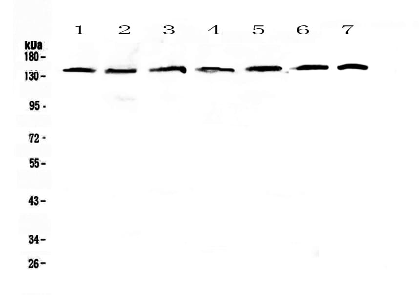EIF2AK3 / PERK Antibody