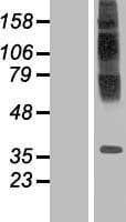 TM6SF1 Protein (Over-Expression Lysate Myc-DDK (Flag))