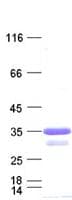 Human DCK / Deoxycytidine kinase Protein (Recombinant His, N-Terminal)