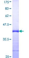 Human Rho Kinase / ROCK1 Protein (Recombinant GST, N-terminus)