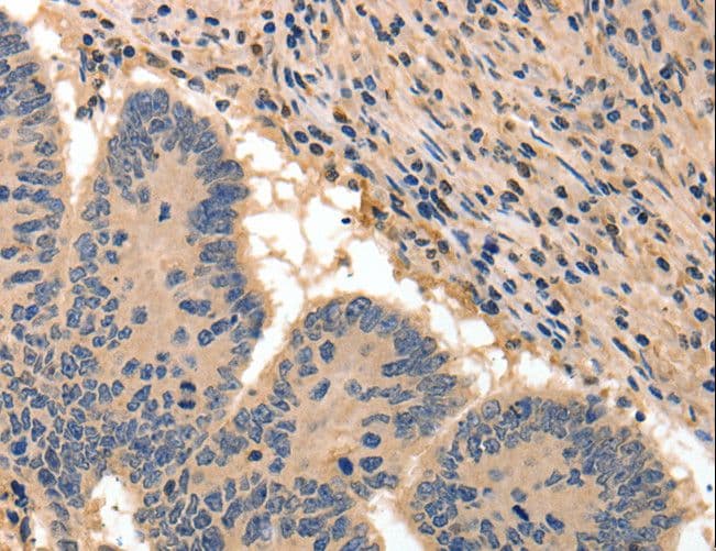 Polyclonal Rabbit anti-Human BAIAP2 / IRSP53 Antibody (IHC)