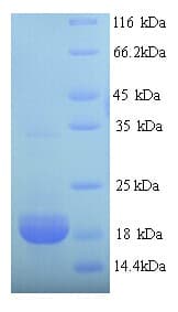 Pig EPO / Erythropoietin Protein (Recombinant His)