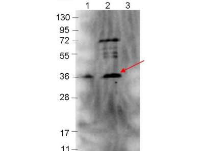Polyclonal Rabbit anti-Borrelia burgdorferi p39 Antibody (Liquid, WB)