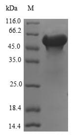 Human FKBPL Protein (Recombinant GST, N-terminus)