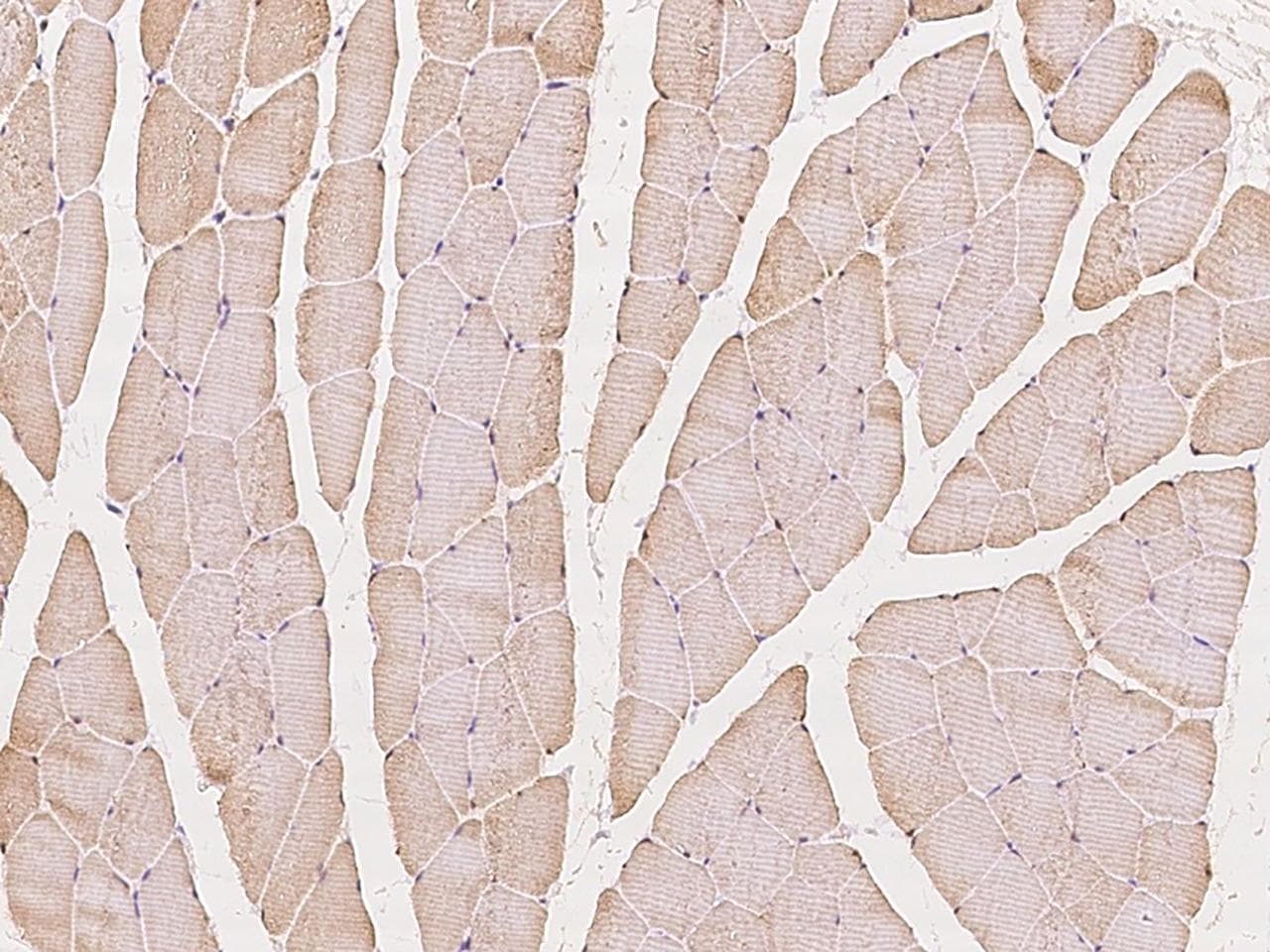 CAPN3 / Calpain 3 Antibody