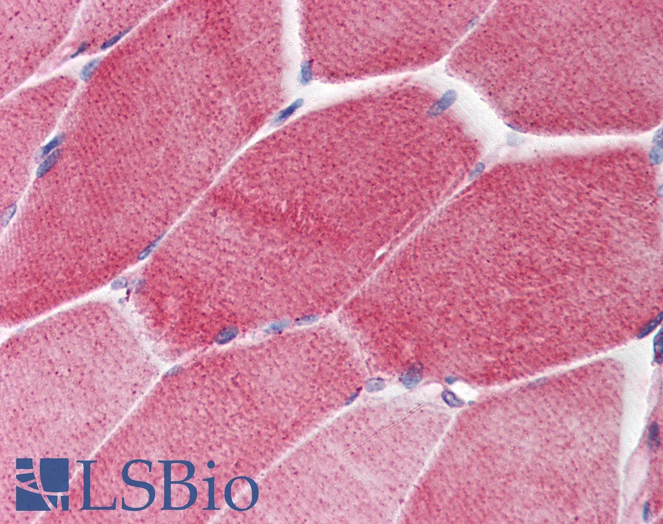 IHC-plus™ PAK2 Antibody