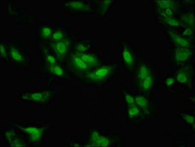 Polyclonal Rabbit anti-Human LDB1 / CLIM2 Antibody (IHC, IF, WB)
